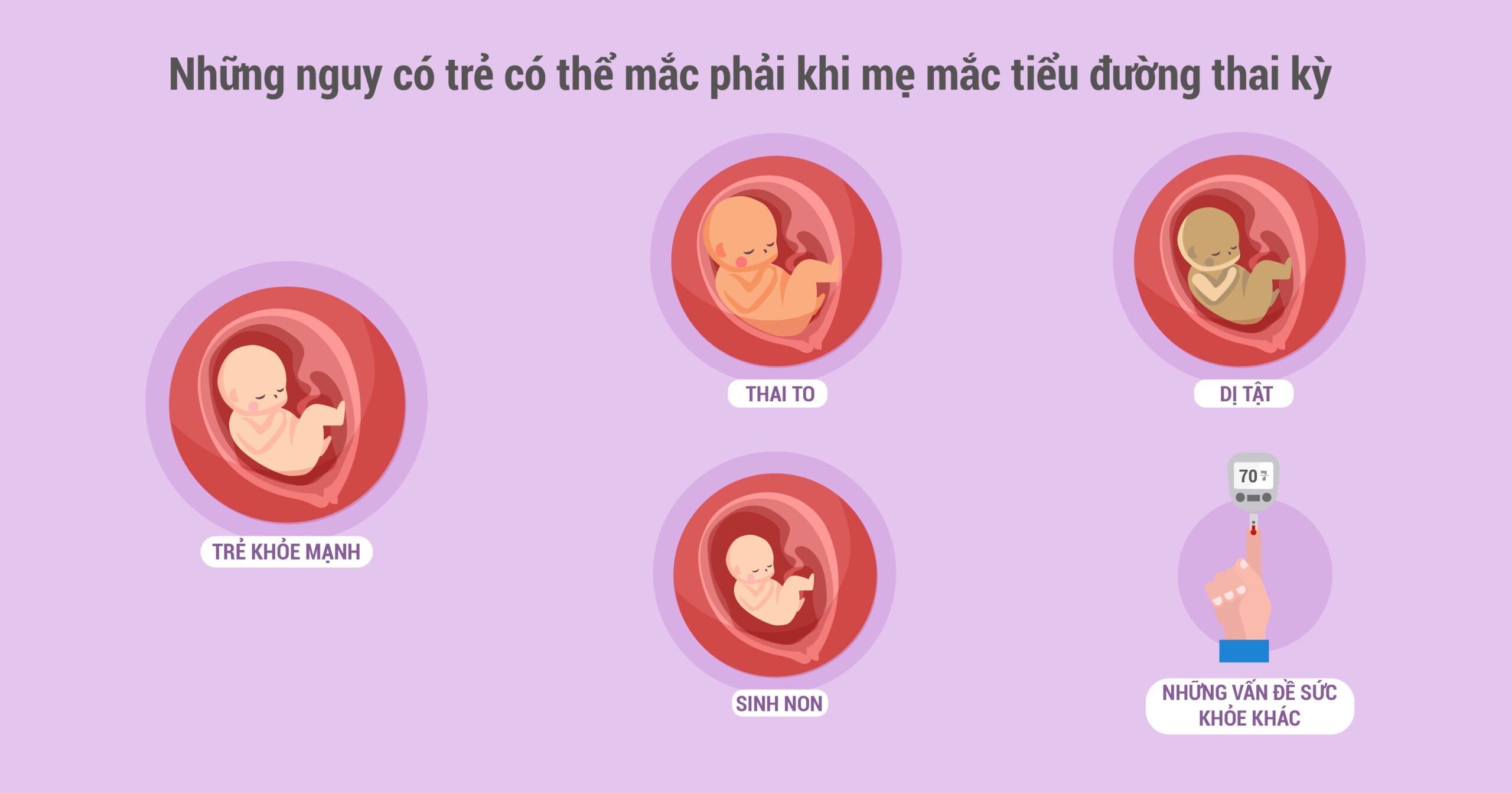 các biến chứng ở trẻ khi mẹ mắc đái tháo đường thai